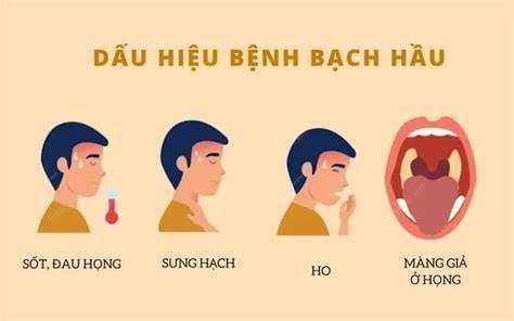 Phân biệt bệnh bạch hầu họng với các chứng viêm họng amidan