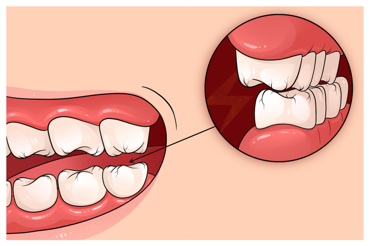 6 dấu hiệu cho thấy bản thân căng thẳng kéo dài