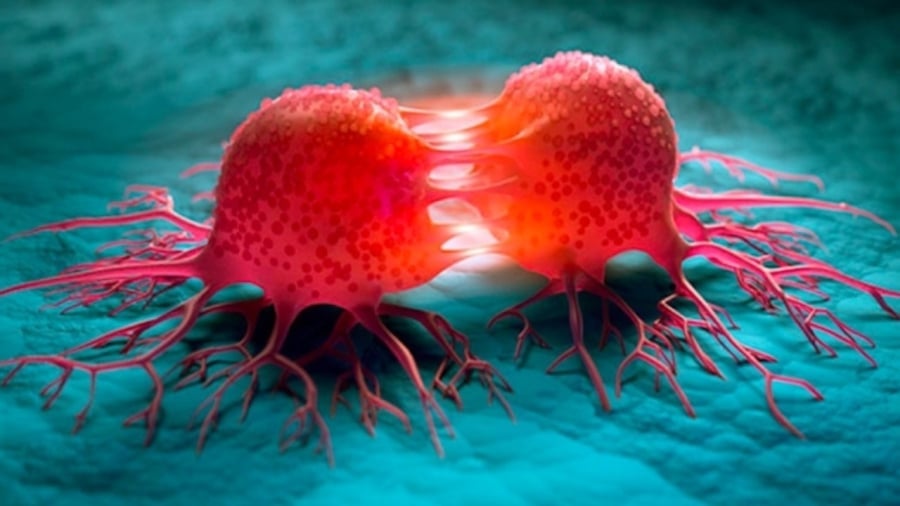 3 dấu hiệu vào buổi tối của người dễ mắc ung thư